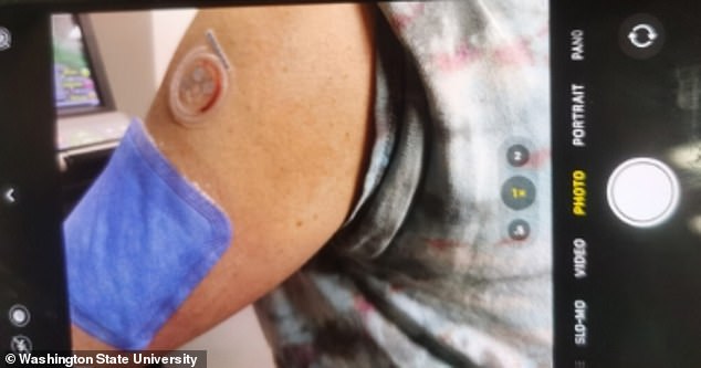 The health monitor measures sweat on a volunteer's arm. As part of the prototype testing, shown above, the sweat was dyed red and the blue patch was used for comparison in the lab.