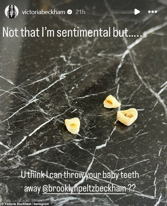 The Spice Girl and the fashion designer, 50, took to Instagram on Sunday to share a photo of the 25-year-old's baby teeth while joking about their nature 