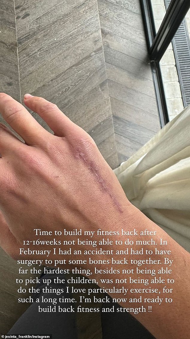 The 32-year-old shared a picture of her scarred hand as it heals after the operation.