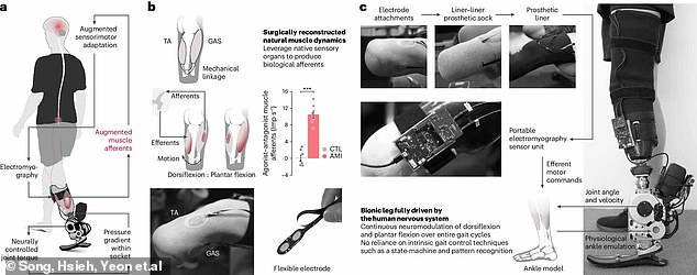 The leg works by recording signals from surgically preserved muscles that are converted into instructions for the electronic ankle.