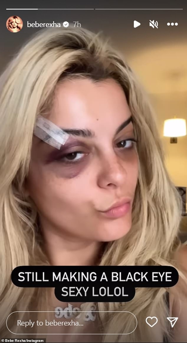 The Thought You Should Know singer is the latest celebrity to have an object thrown at her on stage following similar concerning incidents involving Bebe Rexha (pictured in 2023), Harry Styles, Kelsea Ballerini and Nicki Minaj.