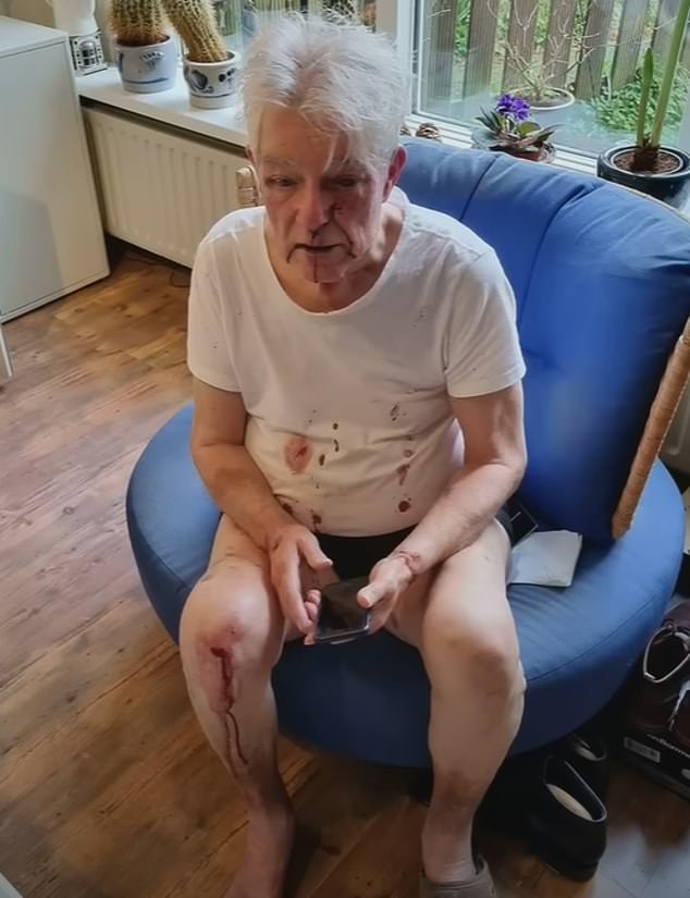 Shocking footage after the assault showed the elderly Dutch man sitting bloodied and confused as he waited for police.