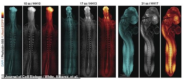 Above, later still images of the initial formation of the embryo's spine and brain.