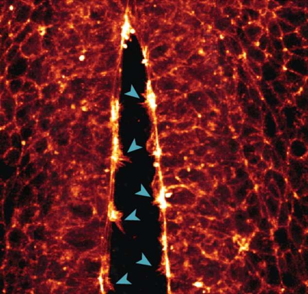 In the image above, the researchers were able to record the formation of arm-like protrusions on individual cells, which help the cells to move along the protein supports of the cytoskeleton to the right place. In the image above, the arms of the cells come together to close the walls of the neural tube.