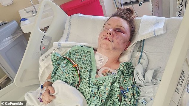 Tessa has nine stab wounds, all of her ribs are broken, one lung is collapsed, her entire right leg has severe third-degree burns, and she is paralyzed from the waist down.