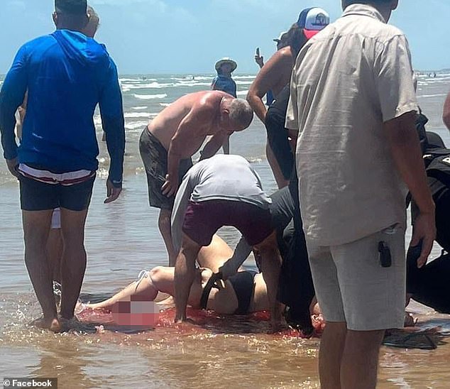 Sullivent is seen bleeding from her leg in the ocean as the group that pulled her out of the water surrounds her.