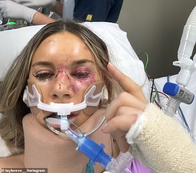 The motocross racer fell off her bike and flew over the handlebars while attempting a jump in the Lockyer Valley on June 29.