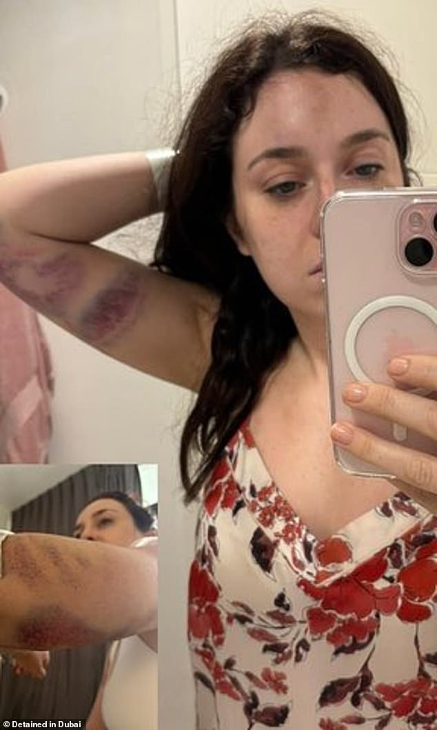 Tori Towey was photographed with extensive bruising all over her body, which she says is the result of an assault.