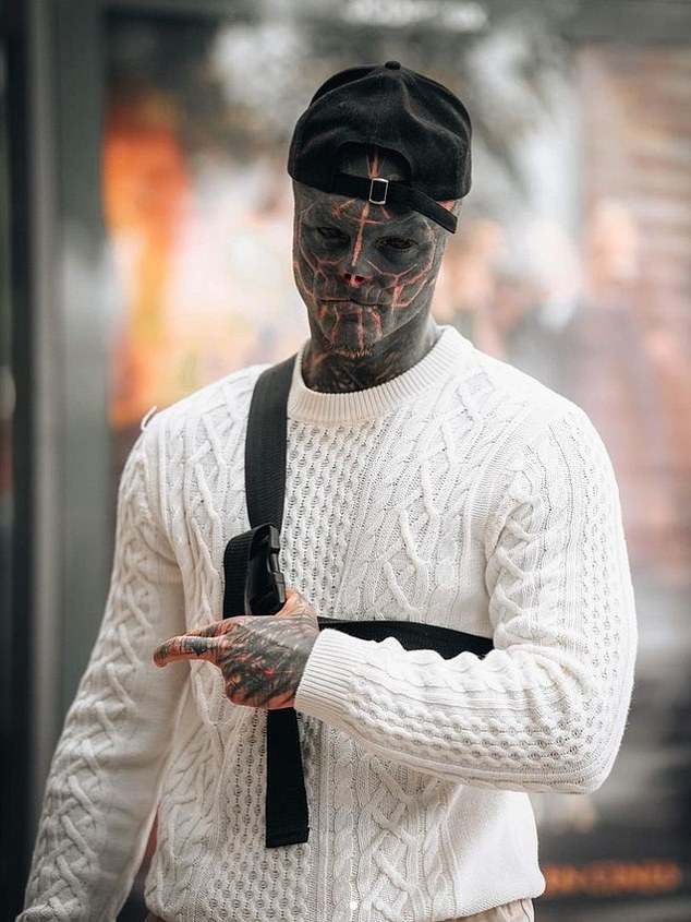 His decision to stop the procedures has coincided with the start of a relationship with tattoo enthusiast Melina Shakur.