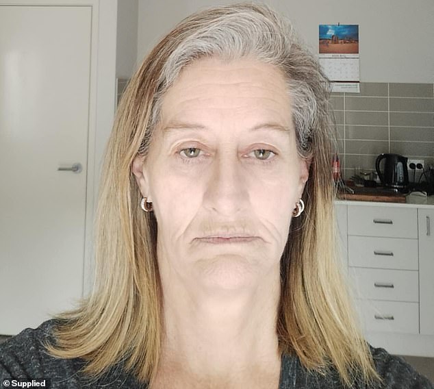 In addition to the physical injuries Ms Glynn (pictured without her implants) has suffered, she has lost several relationships due to social anxiety following the attack.