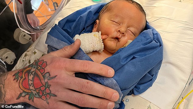 Felix Jean died in March 2022 from complications associated with epidermolysis bullosa (EB), a condition that causes painful blistering and peeling skin.