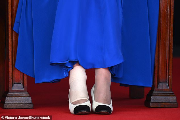 The Queen attended the Special Session of the States of Deliberation at the Parliament of Guernsey this morning wearing a compression bandage on her right ankle.