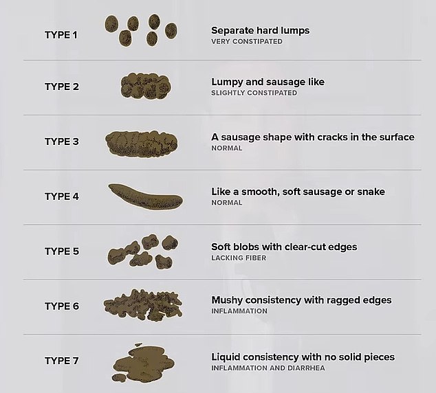 The Bristol stool chart is often used by doctors in clinical practice to assess the health of a person's bowel movements.