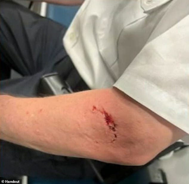 Still photos show a large bite mark on the arm of Brooklyn South District Deputy Patrol Chief Frank DiGiacomo