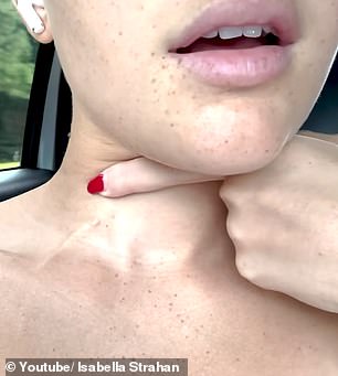 In her latest vlog, Isabella showed off the small tube that had been placed under the skin on her neck and was used to administer chemotherapy drugs.