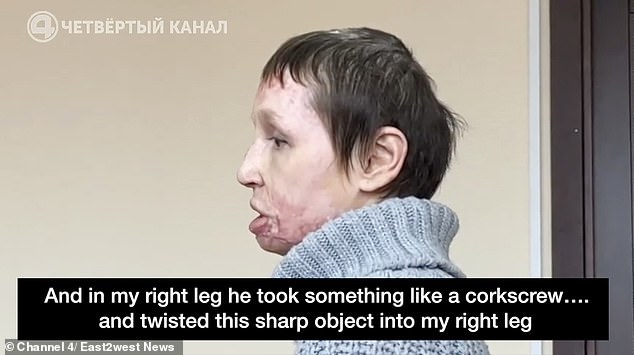 Addressing a court, Kuzmenko recounted the horrific attack in which she was injured in her right leg with a corkscrew.