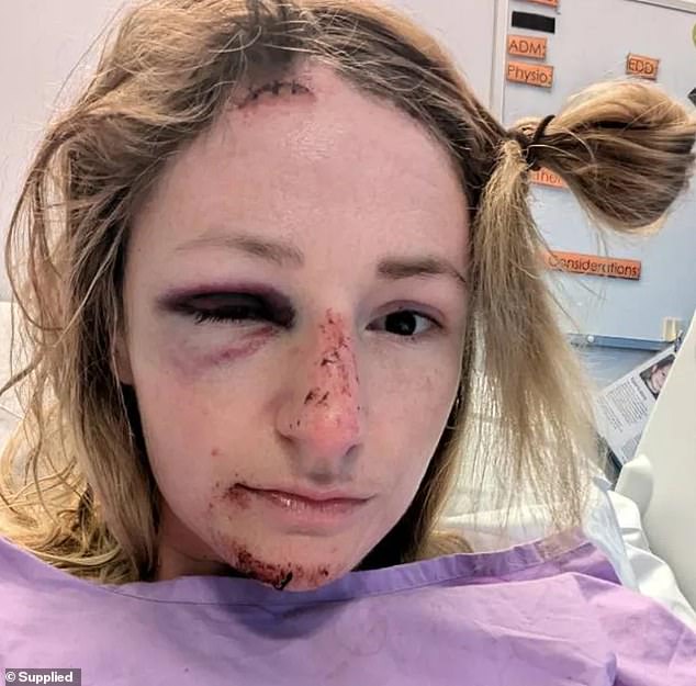 Bridget Harvey was out for a ride on Magnetic Island near Townsville last month when she lost control on a twisty uphill road.