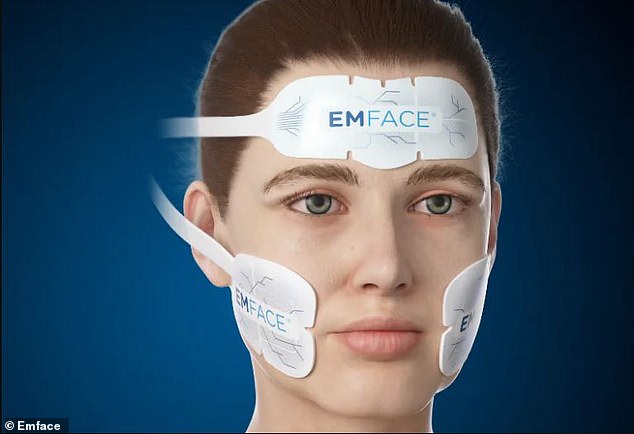 The procedure, called EMFACE, refines and tones neck fat using a pad placed under the chin that emits high-intensity electromagnetic energy.