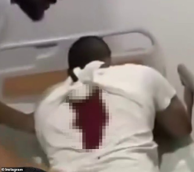 Footage of the terrifying incident, which was later uploaded to social media, shows the man lying face down in a hospital bed, with parts of his shirt covered in blood (pictured)