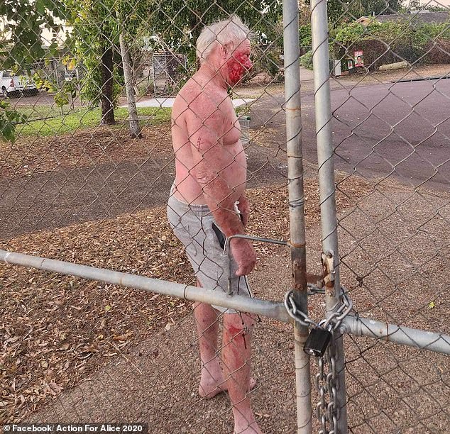 Action for Alice has shared shocking photos following the clash which unfolded at around 7pm on Tuesday in Karama, north of Darwin.