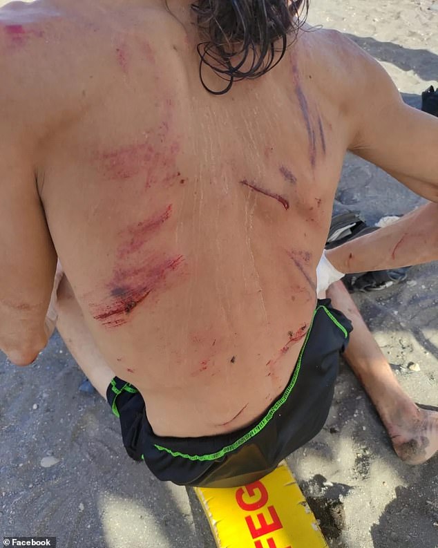 A picture circulating online shows the suspected robber's back covered in cuts after the attack.