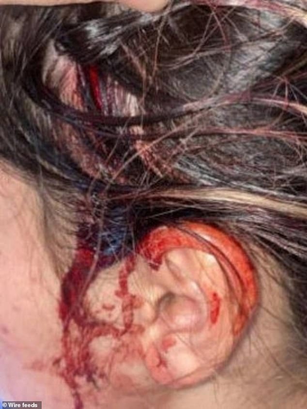 The teenager had to be taken to hospital after the alleged incident left her bleeding from a head wound, with the NRLW star accused of using an unknown object to inflict the injury.