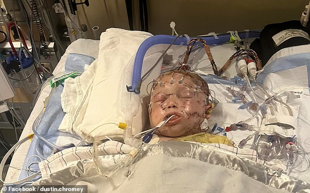 The little boy clung to life for six days in hospital before his death was announced on Thursday.