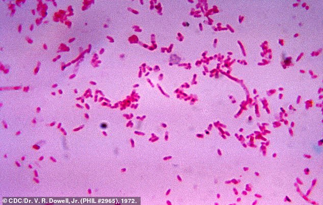 Researchers were surprised that head and neck cancer patients who had Fusobacterium (seen) inside their tumors had 