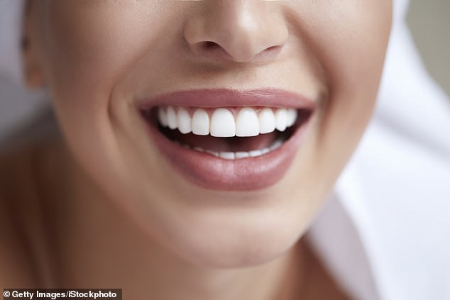 Inge answers: I can't afford to replace my old veneers. Is there an alternative? (archive image)