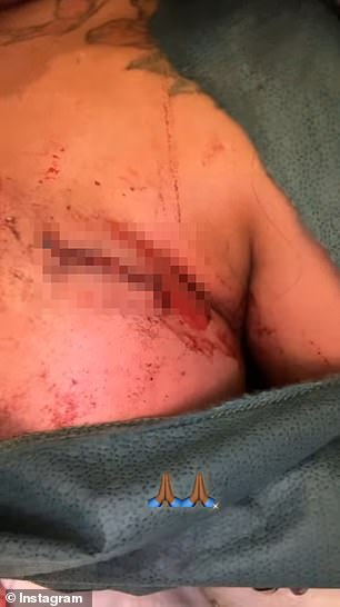 On Sunday night, the Sacramento native shared a bloody and graphic clip of her bruises and gunshot wound, which appeared to have already been stitched up by medical professionals.