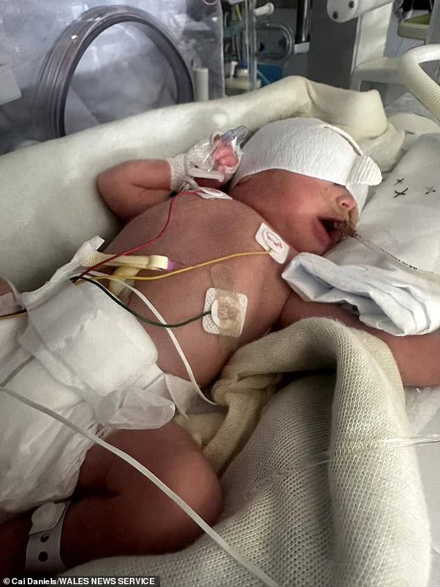 Doctors have told them they need to stay in Tenerife for at least eight weeks until George, who weighed 3lb when he was born, is strong enough to fly home.