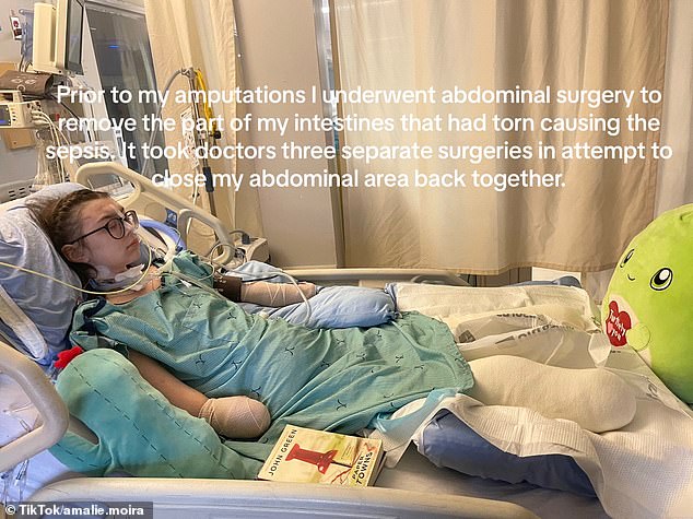 After her surgery, the teenager thought she was experiencing normal Crohn's symptoms, but she was actually diagnosed with septic shock and placed in a medically induced coma.