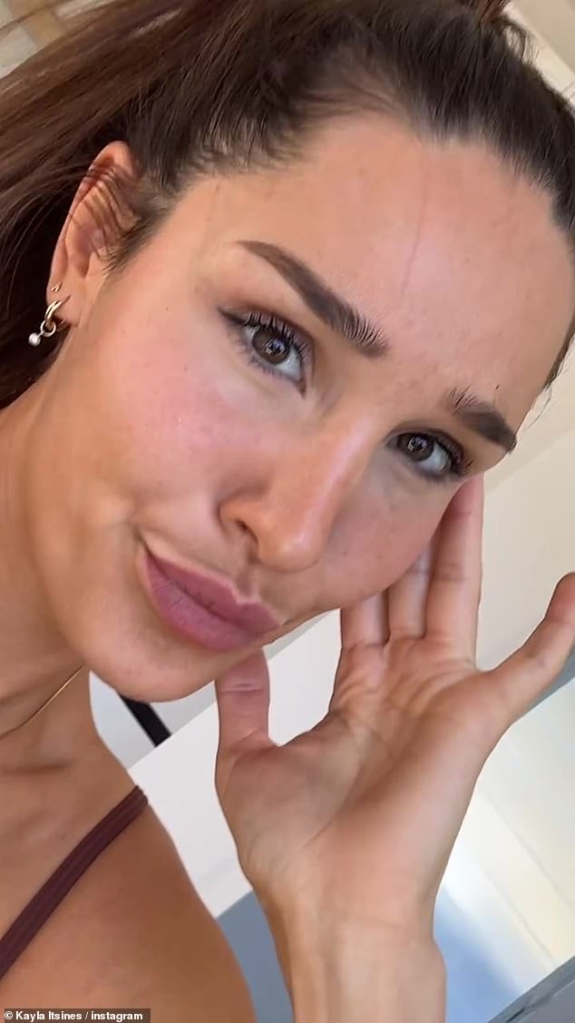 The 33-year-old fitness influencer took to her Instagram Stories on Wednesday to reveal that she cut her forehead while putting on her clothes in the morning.