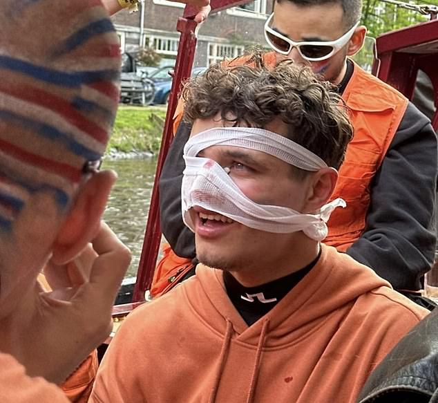 Norris suffered a facial injury while partying on a boat in Amsterdam earlier this year.