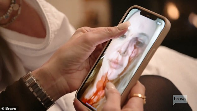 The 60-year-old reality star spoke out about the graphic image after a trailer for the new season of The Real Housewives of Orange County showed her sharing the selfie with a co-star.