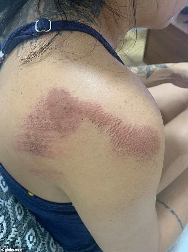 Brazilian school principal Raquel Schwab suffered multiple bruises after being dragged by a driver who she asked not to park on the school's sidewalk.