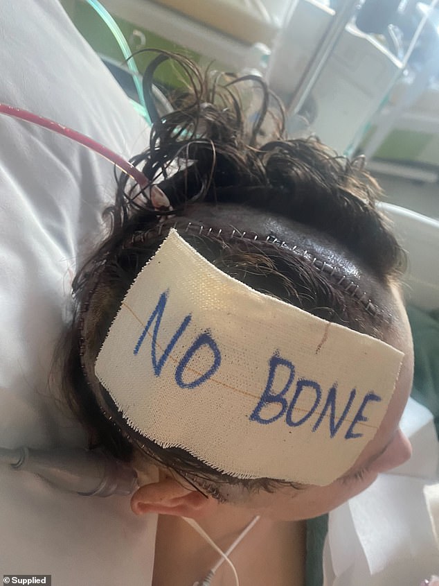 He woke up on his 14th birthday to the news that a large portion of his skull had been removed. While he speaks, he has damage to the nerve in his right eye and will have to learn to walk again.