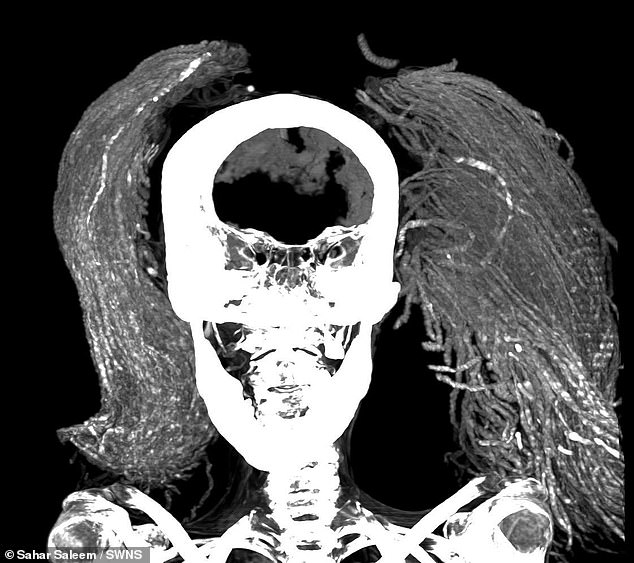 The mummy was discovered with the brain, diaphragm, heart, lungs, liver, spleen, kidneys and intestine still present.