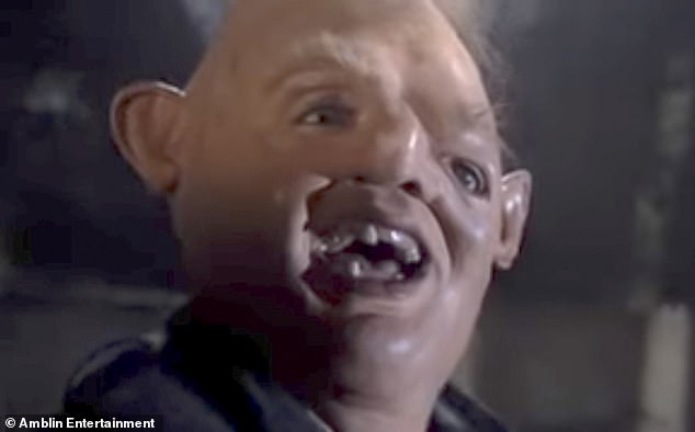 Documenting her recovery from the procedure, which involves placing hair taken from other parts of the body back into the scalp, Bimini posted a photo of Sloth from The Goonies (pictured) with the caption: 