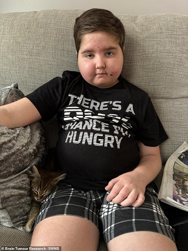 Ronnie, who is unable to return to school, is taking a high dose of steroids to reduce the swelling surrounding the tumor. But an unfortunate side effect of these drugs is that his face and stomach have 