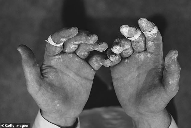 Climbers' hands also become very calloused after years of practicing the sport.