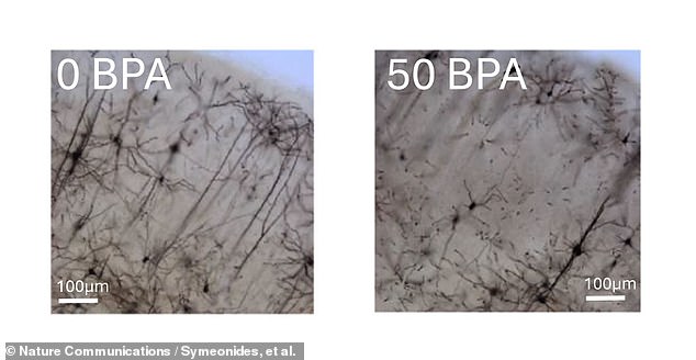 In addition to surveying more than 600 human children, who have been followed since 2010, the study also looked at laboratory mice to analyze the effect BPA has on brain development and autism. Photomicrographs of cortical neurons in laboratory mice (above) show the harmful impact of BPA.