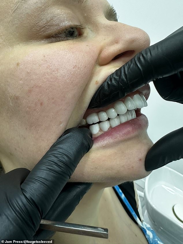 Ms Evans, a content creator who has more than 11,500 followers online, decided to fly back to Turkey to get her teeth fixed.