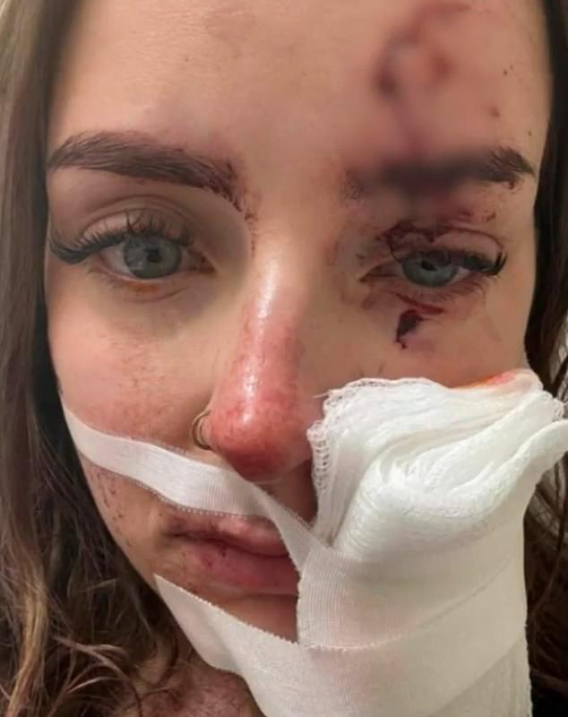 The 20-year-old (pictured) has a cut that barely reaches her right eye, as well as a deep wound on her cheek.