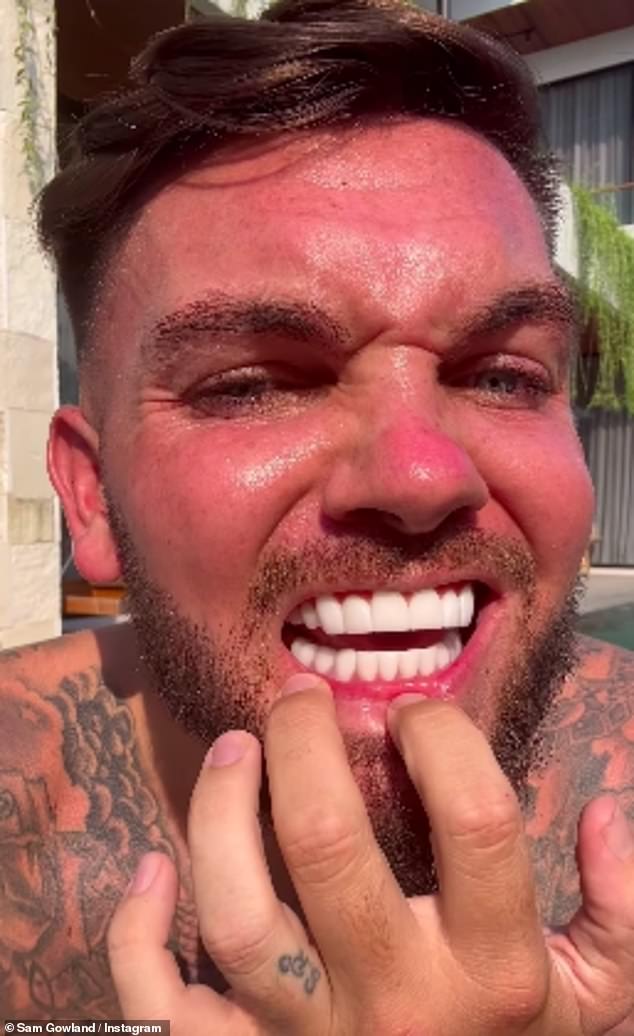 The 2017 Love Island star, 29, took to Instagram with a furious rant after being targeted by trolls for the new look of her teeth, who said they looked 