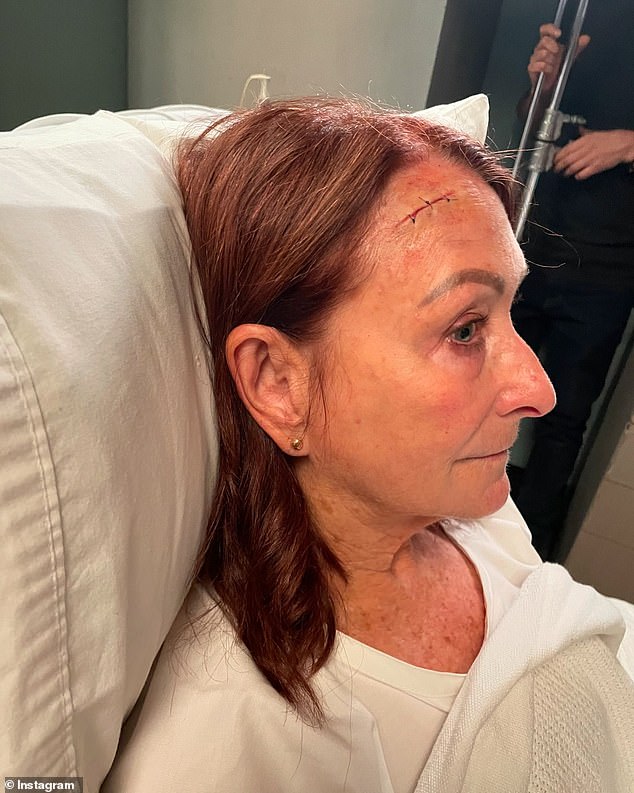 The Home and Away veteran posted the images to Instagram on Tuesday, but thankfully, it was all just special effects makeup.