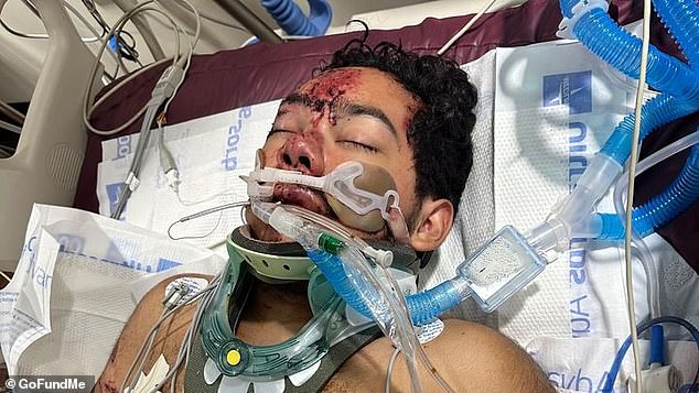 Anthony Rosales is fighting for his life at a local hospital following the accident.