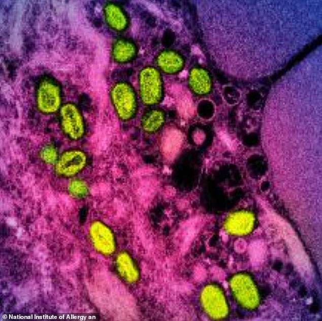 Monkeypox, formerly known as Mpox, is a rare viral infection that is usually contracted in tropical areas of West and Central Africa. Pictured here, a coloured transmission electron micrograph of monkeypox particles (green) found inside an infected cell (pink and purple).