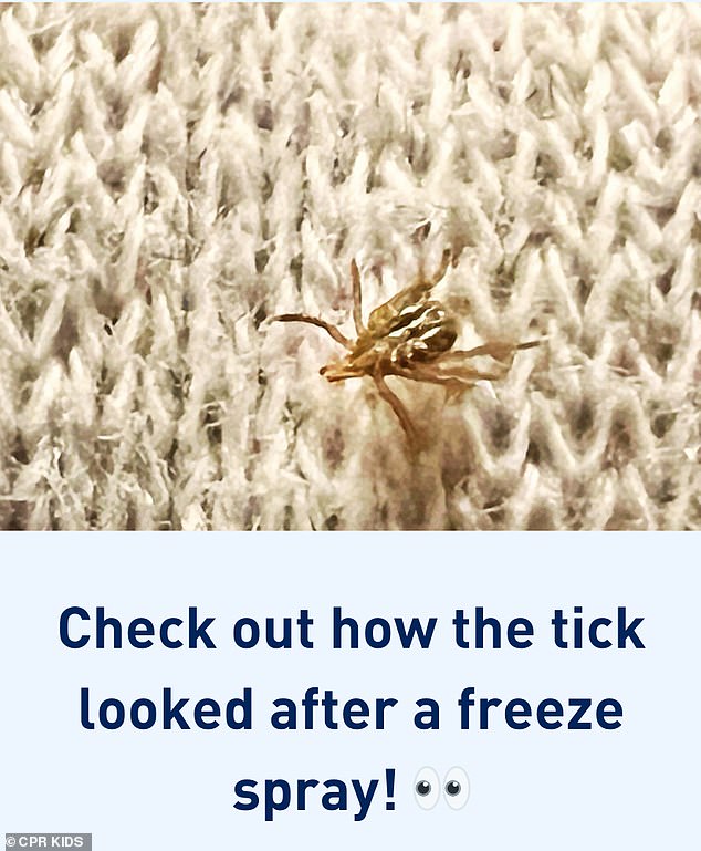 After freezing the tick with a spray containing ether, it died and fell out of his stomach.