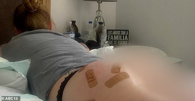 One victim shared a photo of her swollen, bandage-covered bottom after her procedure with Consuelo.